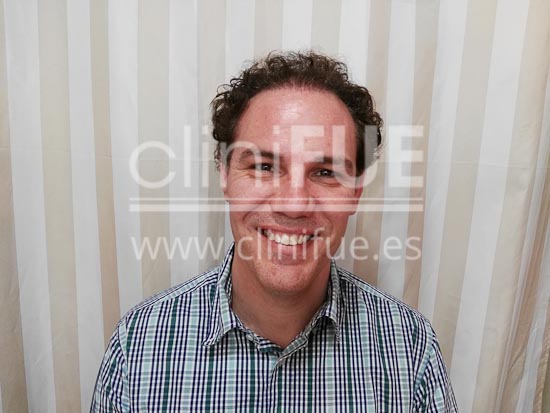 Jorge Aurelio 39 Murcia trasplante turquia 8 meses