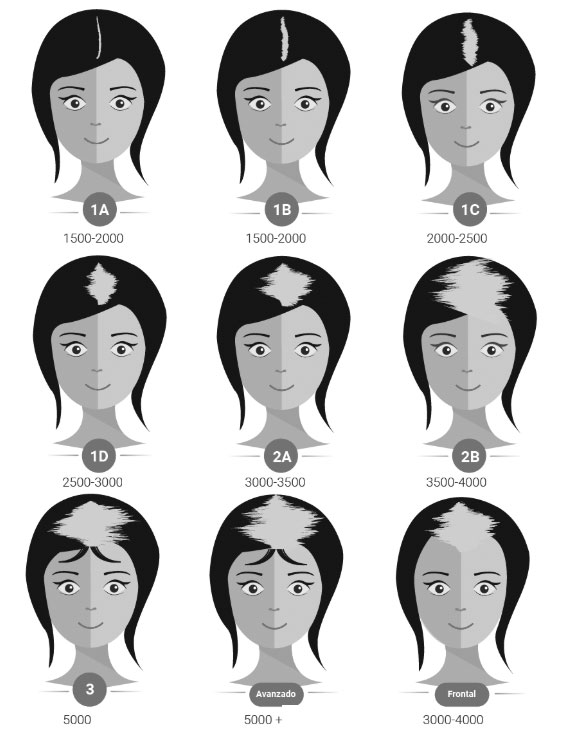 Trucos y consejos para disimular la escasez de pelo  MujerdeElite