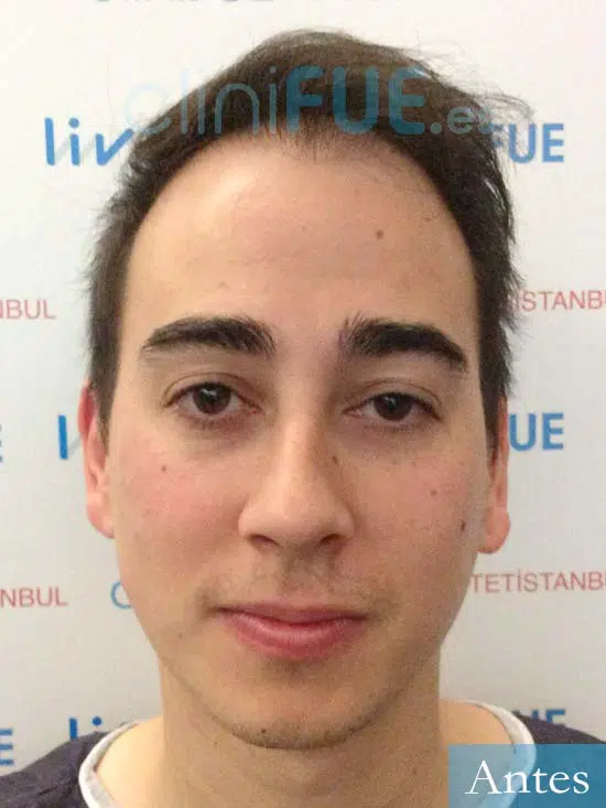 Juan Luis-34-Cordoba-trasplante-turquia-dia operacion-