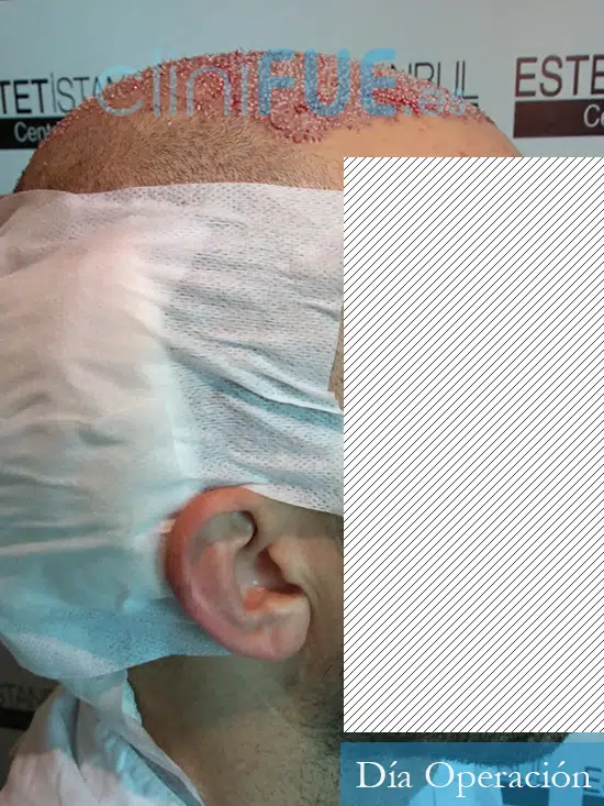 David-32-Madrid-trasplante-turquia-dia operacion-